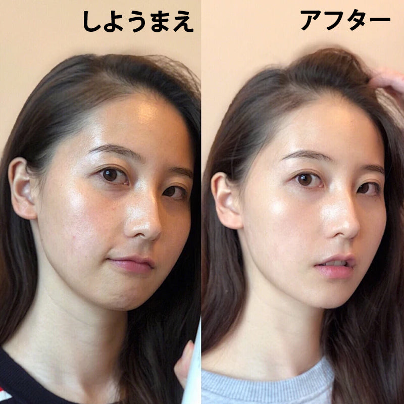 ソソ スージングミスト